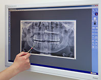 Eine Zahnärztin zeigt auf einen Computermonitor mit einem digitalen Röntgenbild eines Patienten