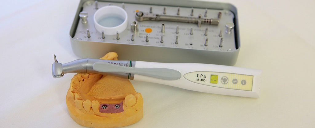 Auf einem weißen Tisch liegt ein Werkzeug-Set, um ein Implantat im Kiefer zu befestigen, ein Modell eines Unterkiefers liegt daneben